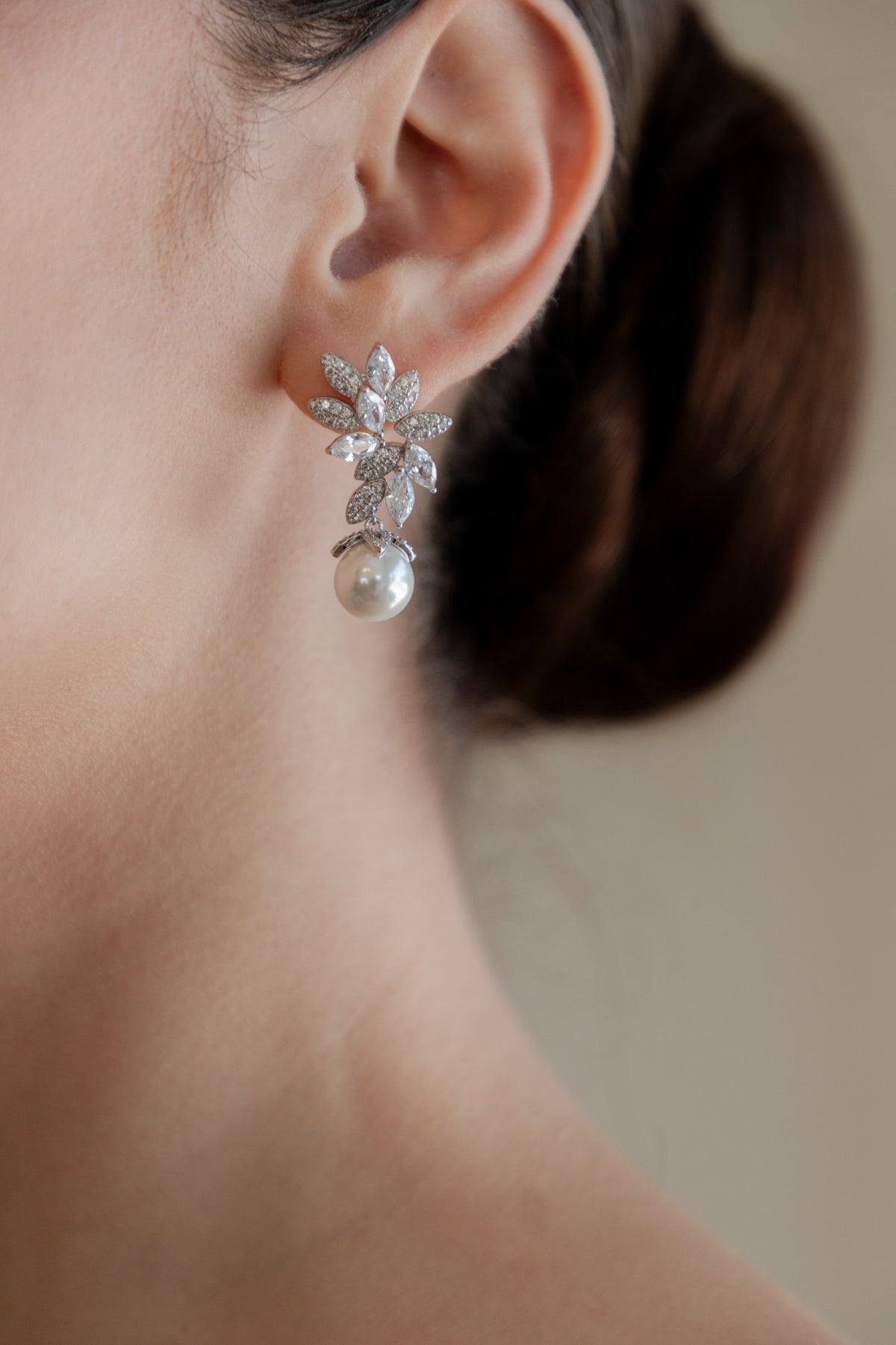 ARETES ER1031